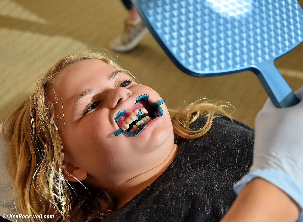 Katie gets braces